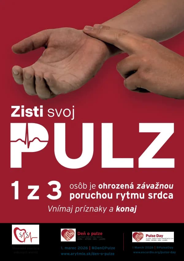Deň o pulze